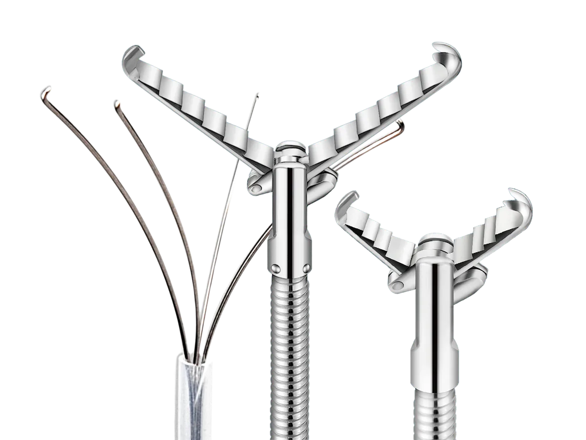 endoscopic removal of foreign body